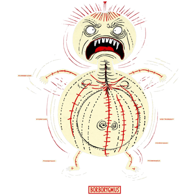 BORBORYGMUS